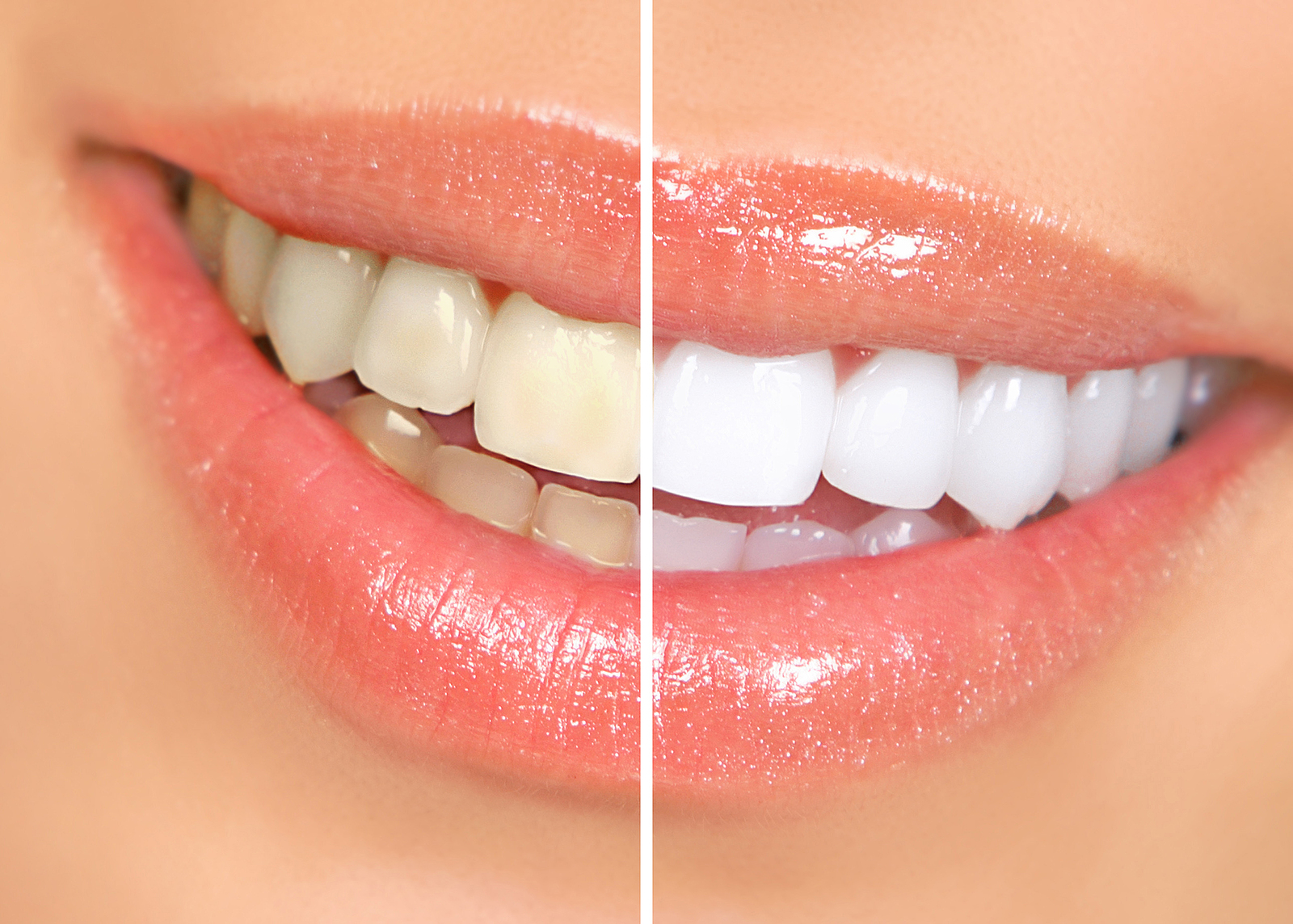 Whitening for Life Whitening for Life